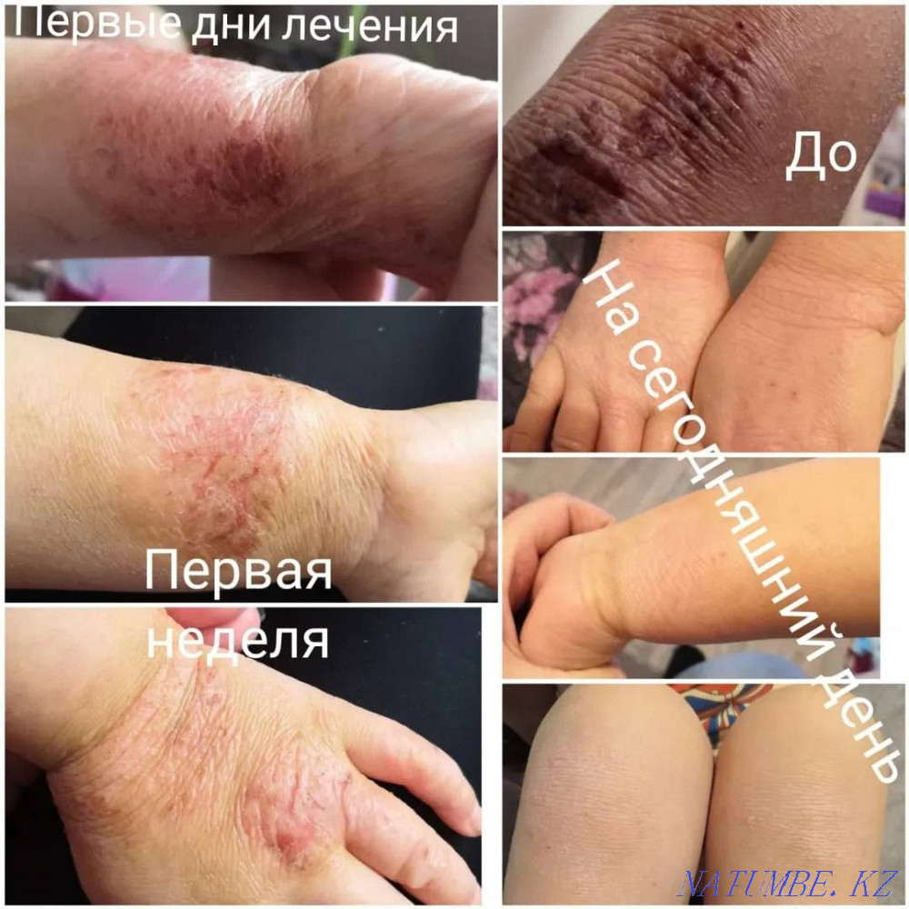 Продаю ШУНГИТОВОЕ МЫЛО+доставка. со скидкой, упаковка 4000 тг=4 штуки Астана - изображение 4