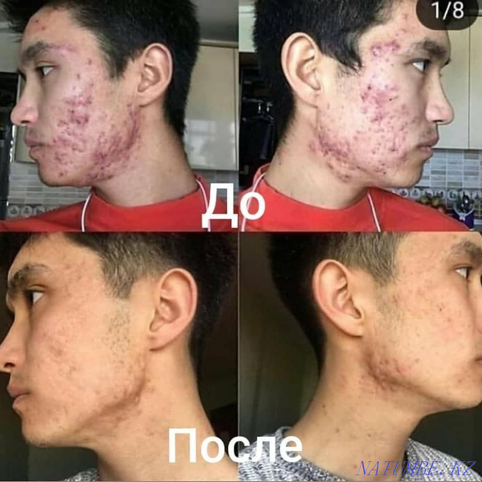Продаю ШУНГИТОВОЕ МЫЛО+доставка. со скидкой, упаковка 4000 тг=4 штуки Астана - изображение 6