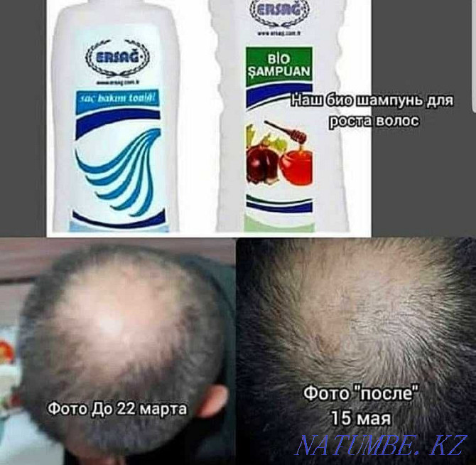 Bio shampoo. Natural shampoo against hair loss. (300 ml) Shymkent - photo 2