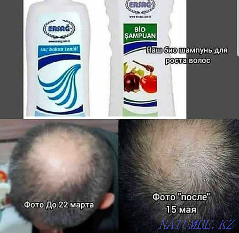 Био шампунь. Натуральный шампунь против выпадения волос. (300 мл) Шымкент - изображение 2