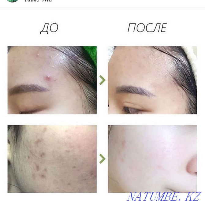 Clay mask stick for acne rejuvenation, etc. Almaty - photo 7