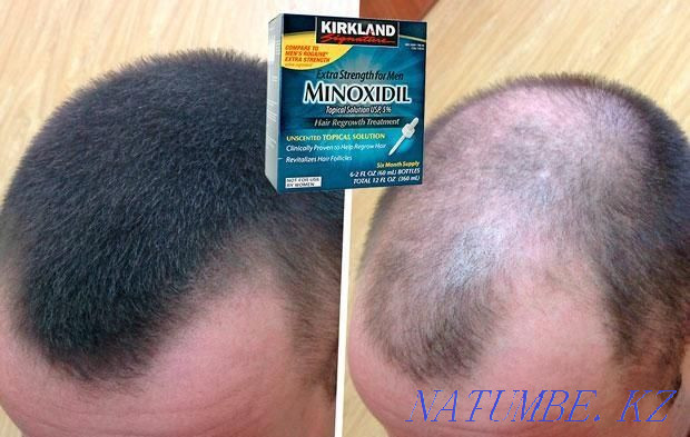 Minoxidil for hair and beard growth Aqtobe - photo 6