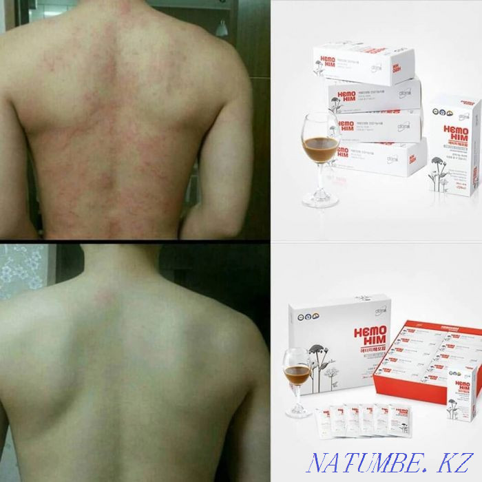 Chemohim Original Korea Atomy Shymkent - photo 8