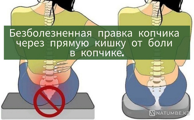 Coccyx pain, coccyx correction Almaty - photo 1