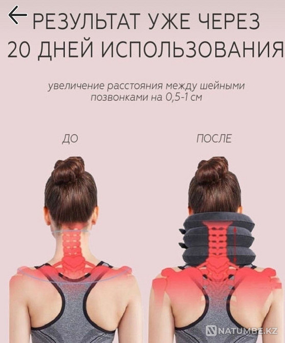 Компрессионый воротник Алматы - изображение 1