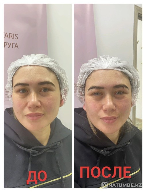 All types of massage Almaty - photo 2