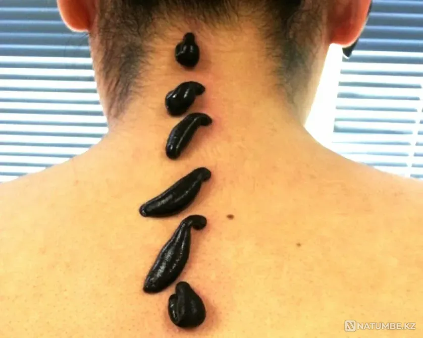 Гирудотерапия, обучающий курс Алматы - изображение 1