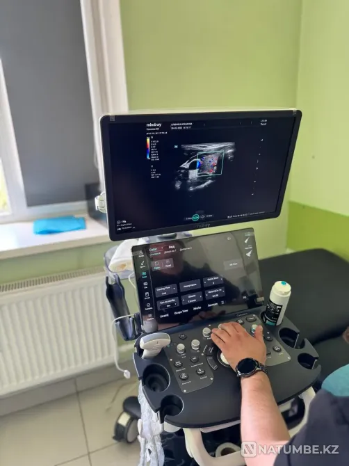 Диагностика УЗИ Павлодар - изображение 2