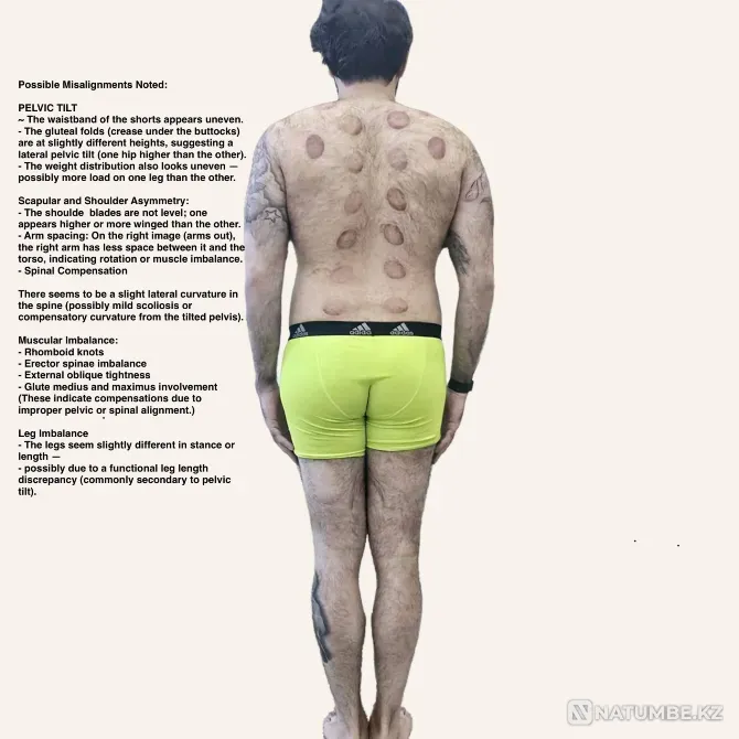 Sports Massage Therapy Almaty - photo 2