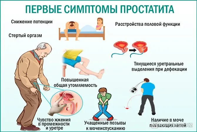 Урологический массаж + осмотр врача за 15000 тг Алматы - изображение 1
