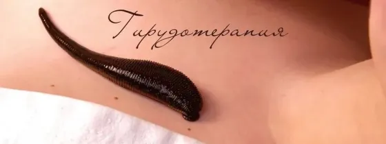 Тәжірибелі дәрігердің гирудотерапиясы: 10 кг-1 сүлік, 2000 тг Алматы